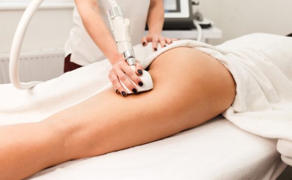 Cellulite Treatment