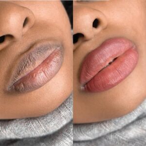 Lip Neutralisation Lip BLUSH