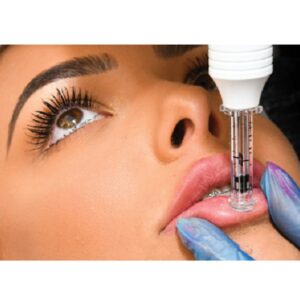 Hyaluron Pen Lip Filler Iml