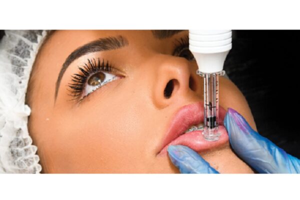 Hyaluron Pen Lip Filler Iml